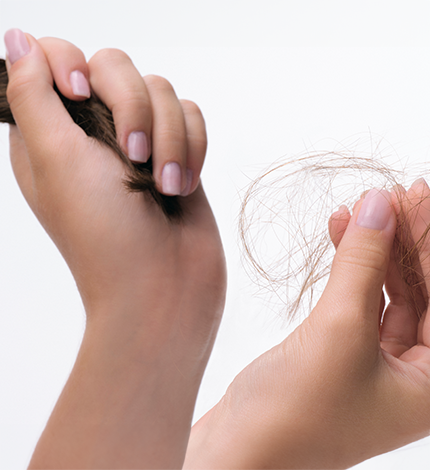 Hair loss or alopecia: causes and treatments